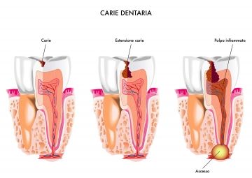 Odontoiatria conservativa ed endodonzia - 1