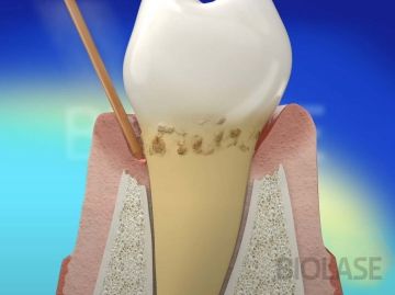 Parodontologia - 2