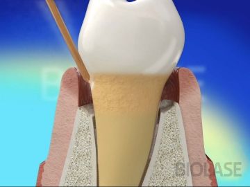 Parodontologia - 3