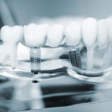 Implantologia e chirurgia